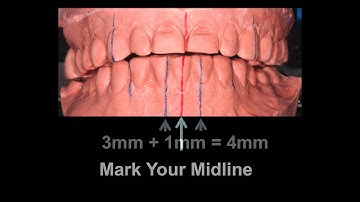 Determining Canine Guidance - Dr. Brian Mills