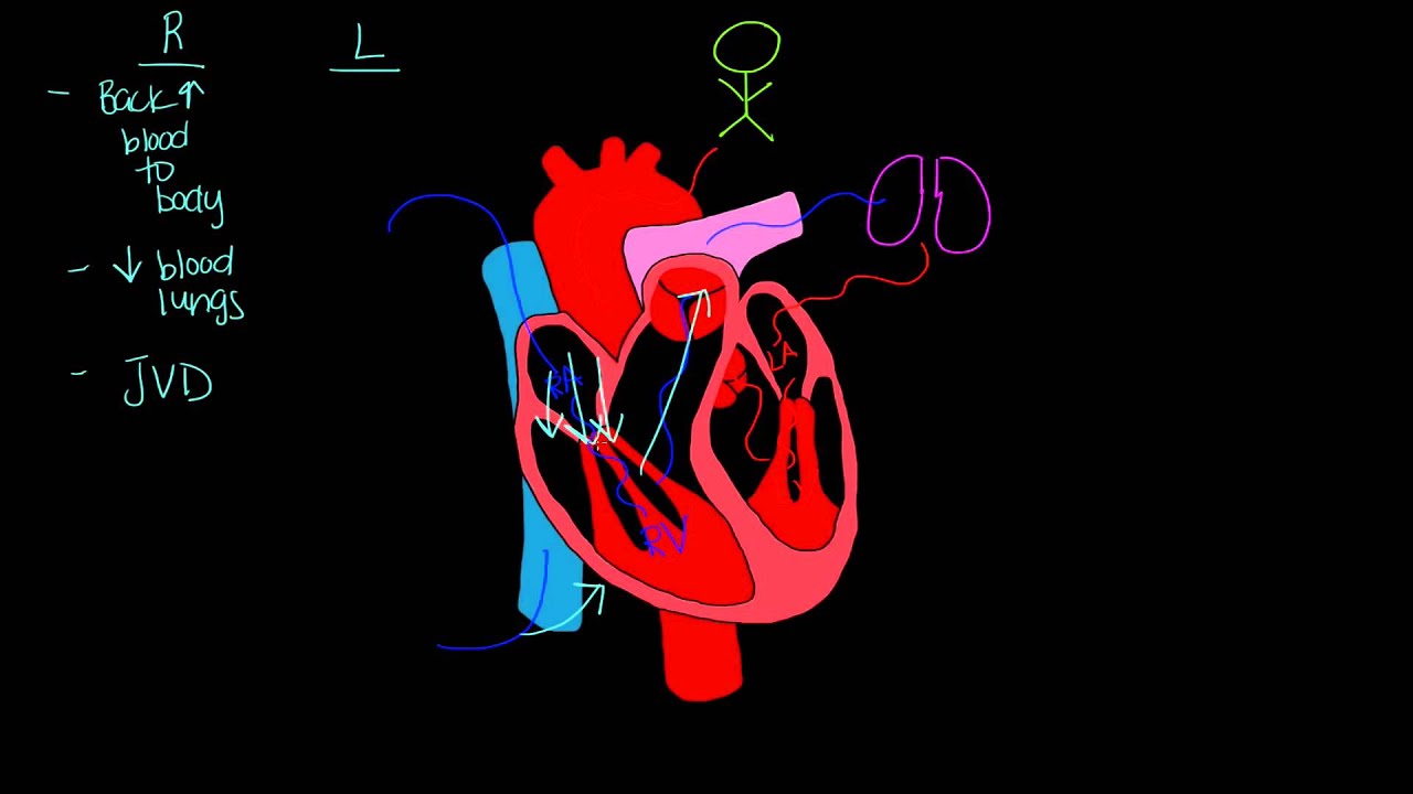 Right Vs Left Sided Heart Failure Chart