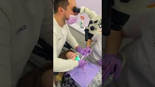 Лікування каналів в UkrMedCenter 🦷❤️#стоматологія #dentist #стоматологиякиев #лікуваннязубів #лікар