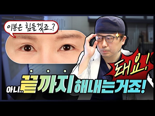 [👁 케이스리뷰 EP.1]극한 눈인 당신도, 포기하지 않아야 하는 이유❗  #눈재수술 #케이스리뷰 #극한눈
