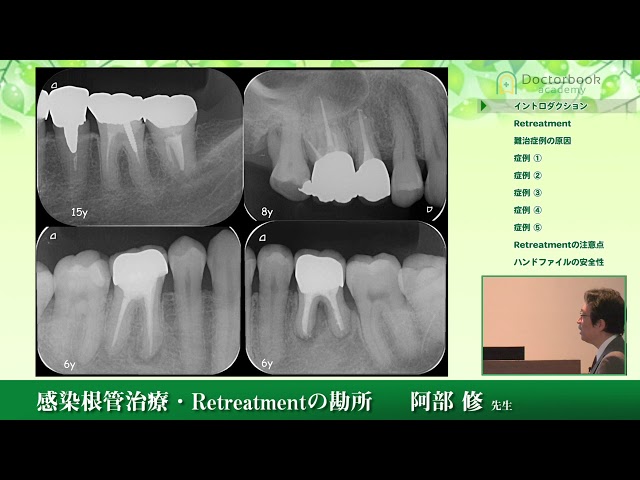感染根管治療 Retreatment―感染制御の要点を知る (歯内療法成功への道) 感染根管治療 Retreatment―感染制御の要点を知る (歯内療法成功への道