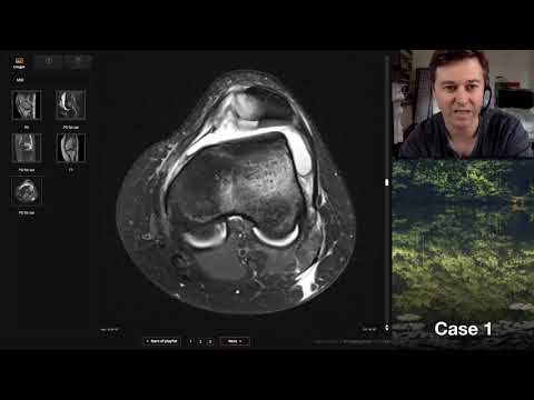 Isolation tutorial: Knee MRI with Andrew Dixon