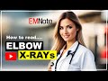 How to read elbow radiograph critoe