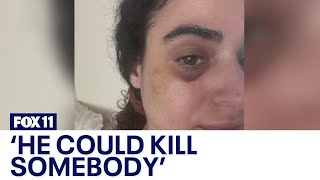 Fairfax woman attacked by homeless man while walking dog