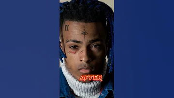 Rappers Before And After Fame PT.1 #youtubeshorts #rap #edit #xxxtentacion #juicewrld #popsmoke