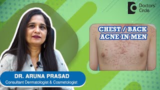 CHEST / BACK ACNE IN MEN. How to get rid of Chest Acne in Men? - Dr. Aruna Prasad | Doctors' Circle