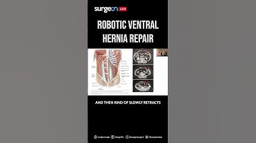 Navigating Complex Robotic Ventral Hernia Repai