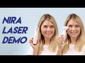 NIRA Laser Demo for Crow's Feet and Hooded Eyes - Over 40