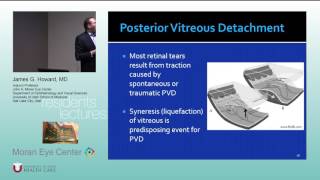 Retinal Detachment