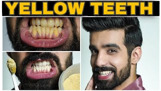 Teeth Whitening at Home|FAST| 100% EFFECTIVE|Yellow Teeth NATURAL remedy| Hindi|Men& Women
