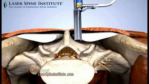 Daytime - Laser Spine Institute with Dr. Prada