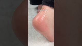 my secret to soft feet all winter screenshot 2