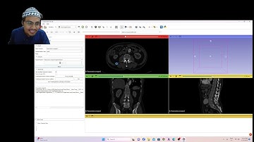 Deep Learning Segmentation 3D Slicer: TotalSegmentator
