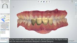 Performing a diagnostic wax up design