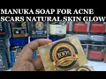 acne scars whitening beauty manuka honey soap