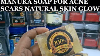 acne scars whitening beauty manuka honey soap