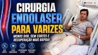 CIRURGIA ENDOLASER PARA VARIZES 
