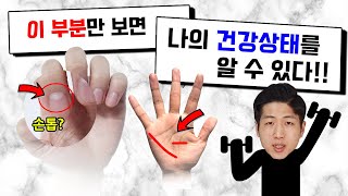 손만 보면 건강을 알수있다고? Feat 손금보는법