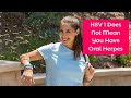 HSV 1 Does Not Mean You Have Oral Herpes