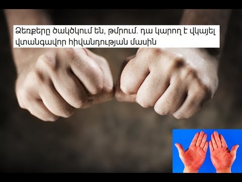 Video: Կարո՞ղ են լինել նկարչի գծերը: