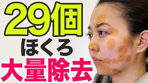 تحميل ほくろを消す方法 ムヒ
