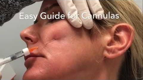 Easy Guide System for Blunt Cannulas - Dermal Fillers - Steven F Weiner, MD