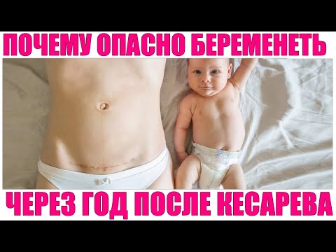 БЕРЕМЕННОСТЬ В ТЕЧЕНИЕ ГОДА ПОСЛЕ КЕСАРЕВА СЕЧЕНИЯ | Когда можно забеременеть после кесарева сечения