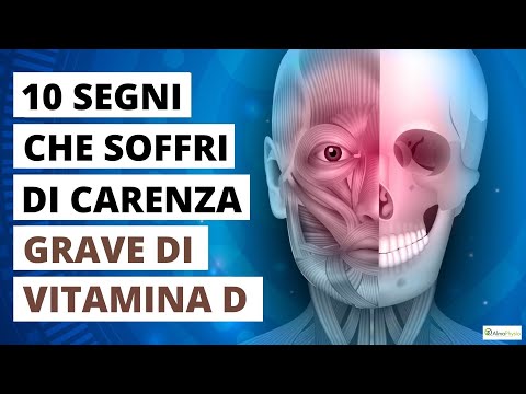 🤧 Ecco cosa ti succede se hai una Carenza di Vitamina D