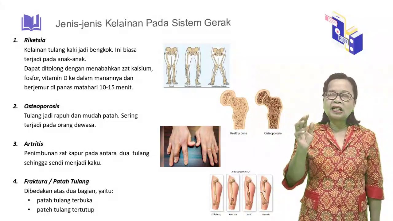 Gangguan/Kelainan pada sistem gerak Manusia - Biologi Kelas 8 