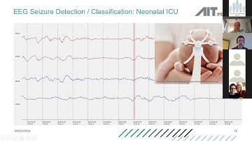 Improved Diagnostic by analyzing Electrical Biosignals with Deep Learning