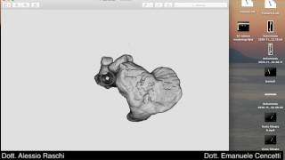 Surface rendering, modello 3D tibia per stampanti 3D
