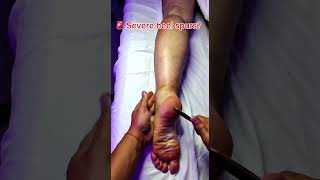 They’re built over time from stress, imbalance, and constant pulling through the fascia !