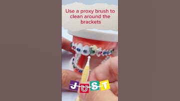 How to floss with braces 🦷