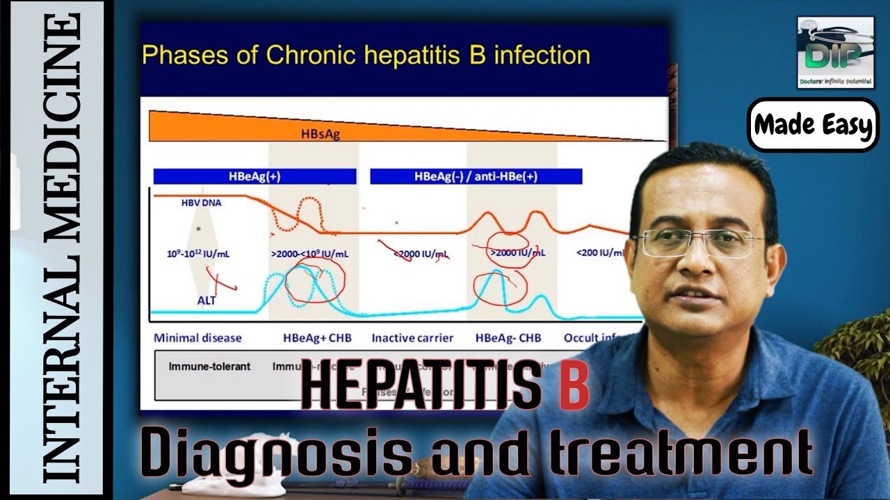 Internal Medicine | Diagnosis & treatment of Chronic Hepatitis B | Prof ...