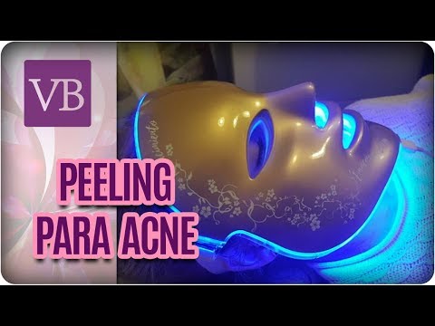 Peeling de Led Azul Para Tratamento da Acne - Você Bonita (03/04/18)