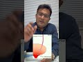 VUJ URETER STONE #uretericstone #kidneystones #kidneystonekailaj