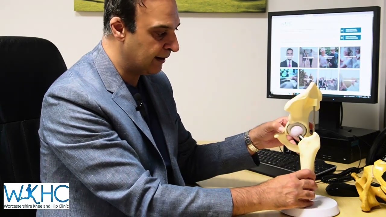 SMART Robotic Surgeon ™ | Total Hip Replacement.