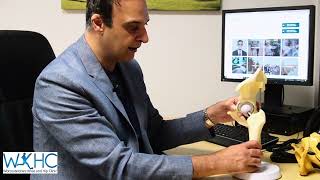 SMART Robotic Surgeon ™ | Total Hip Replacement.