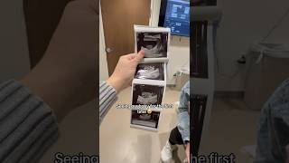 Famous Seeing our baby for the first time ❤️ Profile