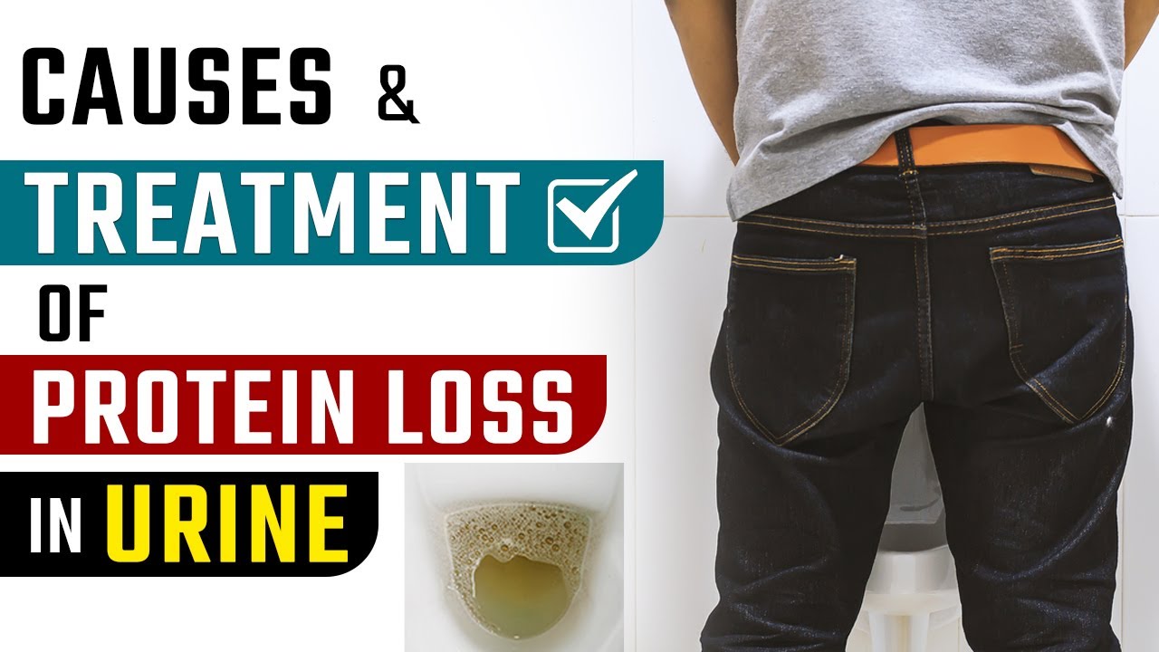 Causes And Treatment Of Protein Loss In Urine YouTube