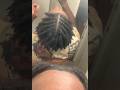 Crazy growth 3 months dread update/budding/itching &amp; fuzz phase