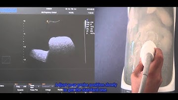 CHISON 4D training video