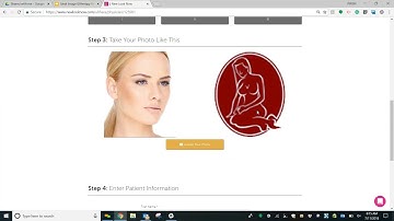 Webinar: Ultherapy Visualizer
