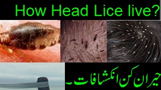 Head Lice|How They Live ?Life Cycle Of Head Lice(Urdu\/Hindi)The wisdom Crew||