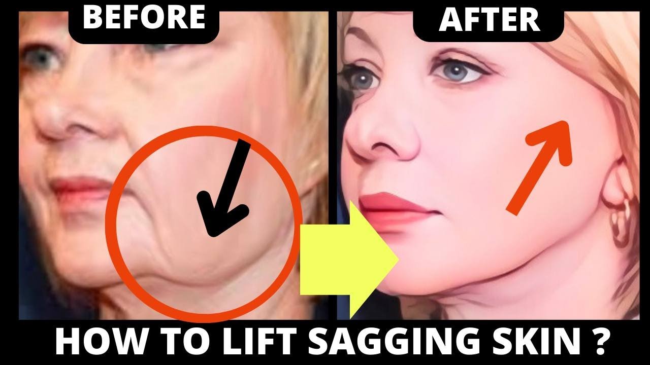 🛑 CHISELED JAWLINE EXERCISE | LIFT SAGGY SKIN, JOWLS, LAUGH LINES, FOREHEAD LINES, FROWN LINES ...