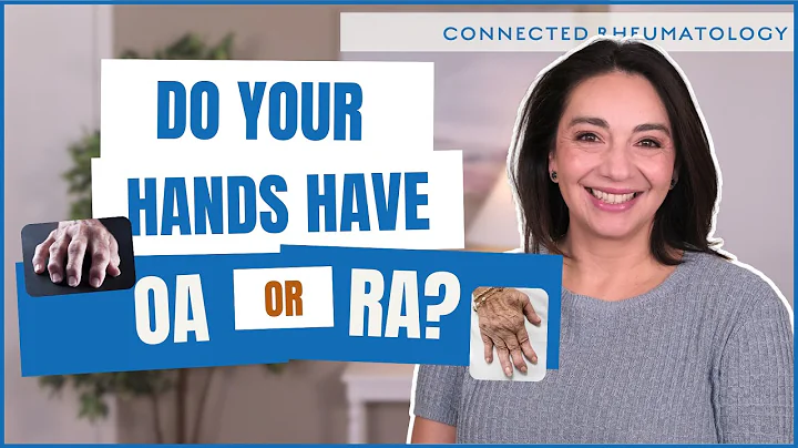 5 Signs Your Hand Pain Needs a Rheumatologist