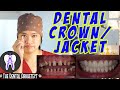 Dental Crown Jacket What S It For DentalCrown Jacket Dental Dental Crown Jacket What S It For DentalCrown Jacket Dental