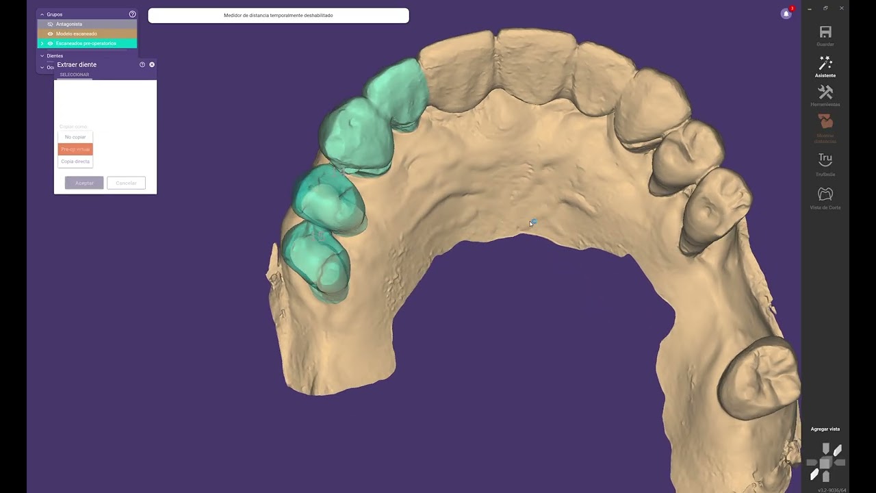 DENTADURA IMEDIATA 2B 15 02 26