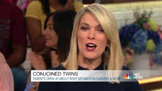 ‘Megyn Kelly TODAY. Emily and James Stark gave birth to conjoined twins Lexi and Sydney Stark.