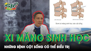 Những Bệnh Cột Sống Mà Bơm Xi Măng Sinh Học Có Thể Điều Trị | SKĐS